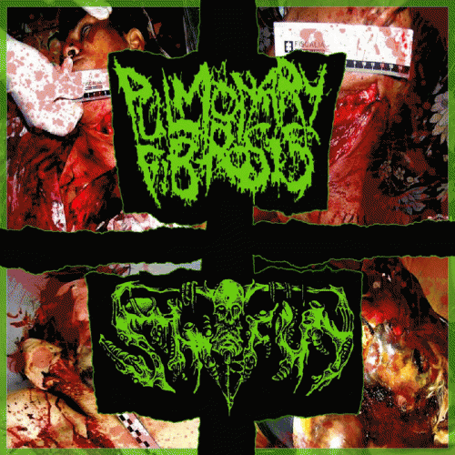 ShitFun : Pulmonary Fibrosis Shitfun